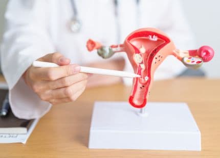 Polycystic Ovary: Symptoms, causes and treatment
