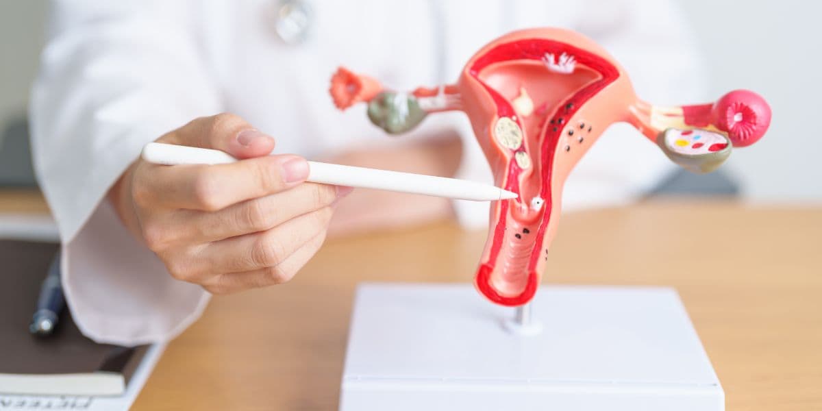 Polycystic Ovary: Symptoms, causes and treatment